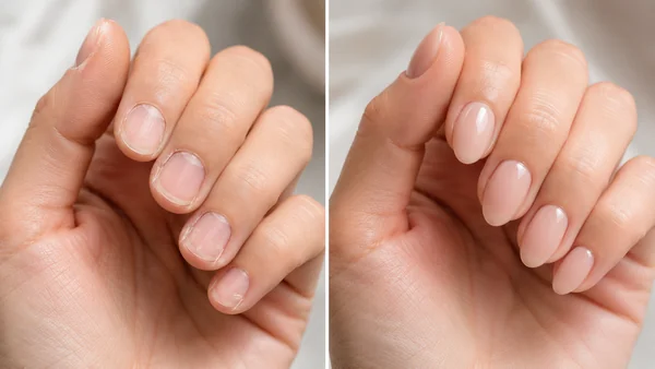 Avant/après d'une pose de press-on nails sur des ongles courts et abîmés pour un rendu naturel et soigné.
